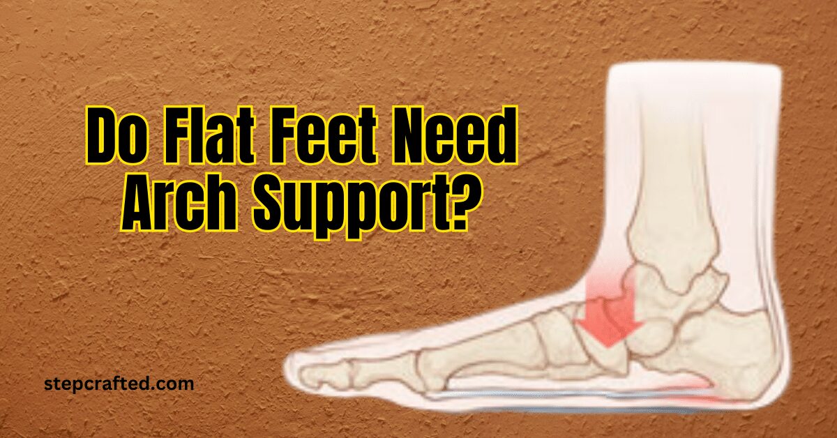 Do Flat Feet Need Arch Support?