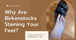 Birkenstocks Staining Your Feet